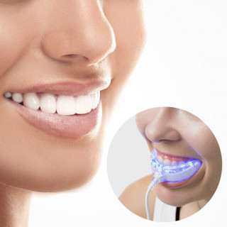 InnovaGoods Professional teeth whitener Home